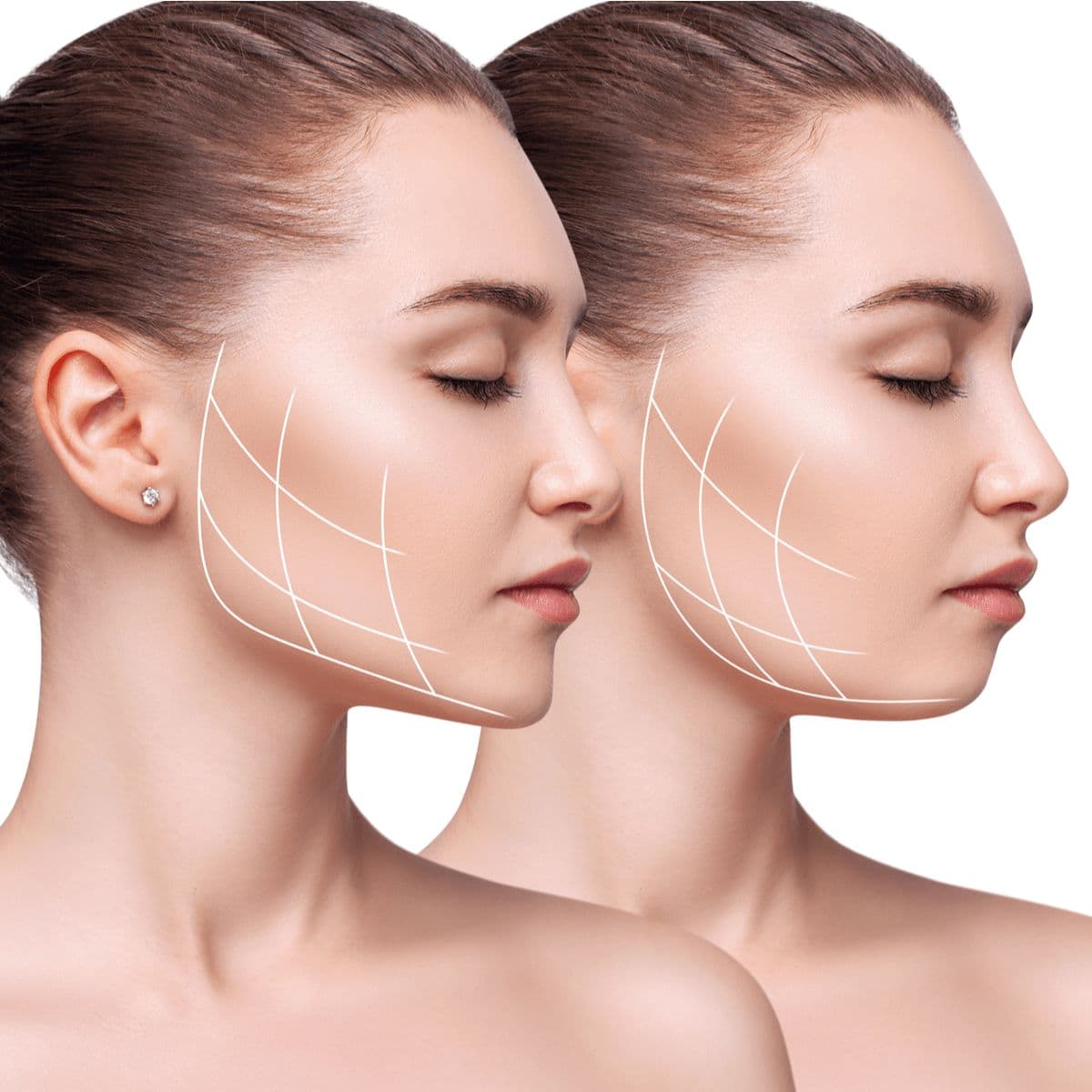 Premium body contouring consultation for liposuction and Lipo 360