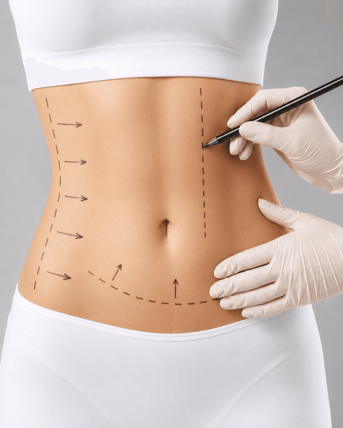 Luxury plastic surgery consultation for tummy tuck body contouring